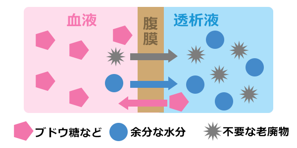 腹膜透析の仕組み