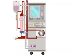 腹膜透析の基本