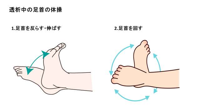 シャントの狭窄