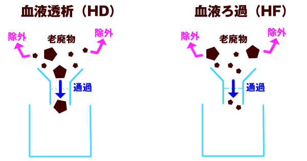 血液透析(HD)と血液ろ過（HF）の図1