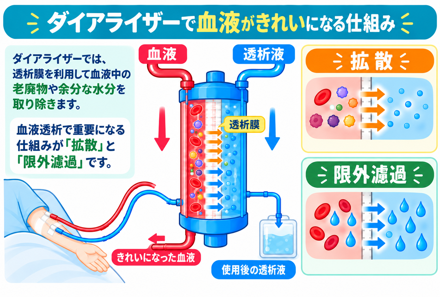 ダイアライザーの仕組み